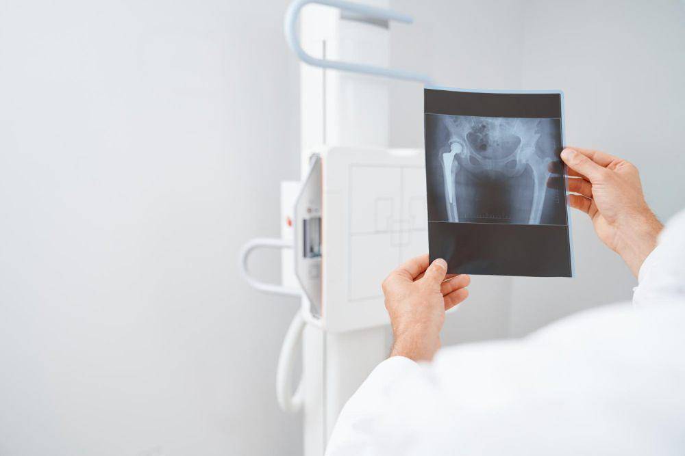 ilustrasi x-ray tulang (freepik.com/serhii_bobyk)