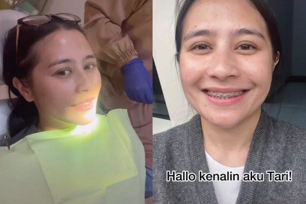 7 Potret Terbaru Prilly Latuconsina Pakai Behel, Totalitas Demi Peran