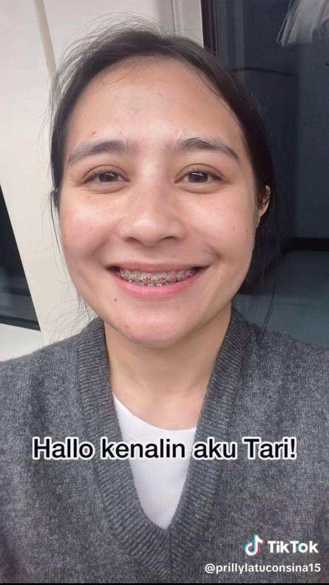 Penampilan baru Prilly pakai behel (Tiktok.com/prillylatuconsina15)