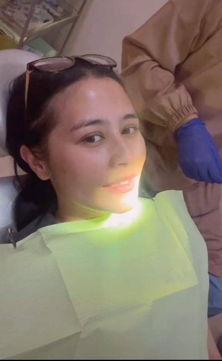 Penampilan baru Prilly pakai behel (Tiktok.com/prillylatuconsina15)