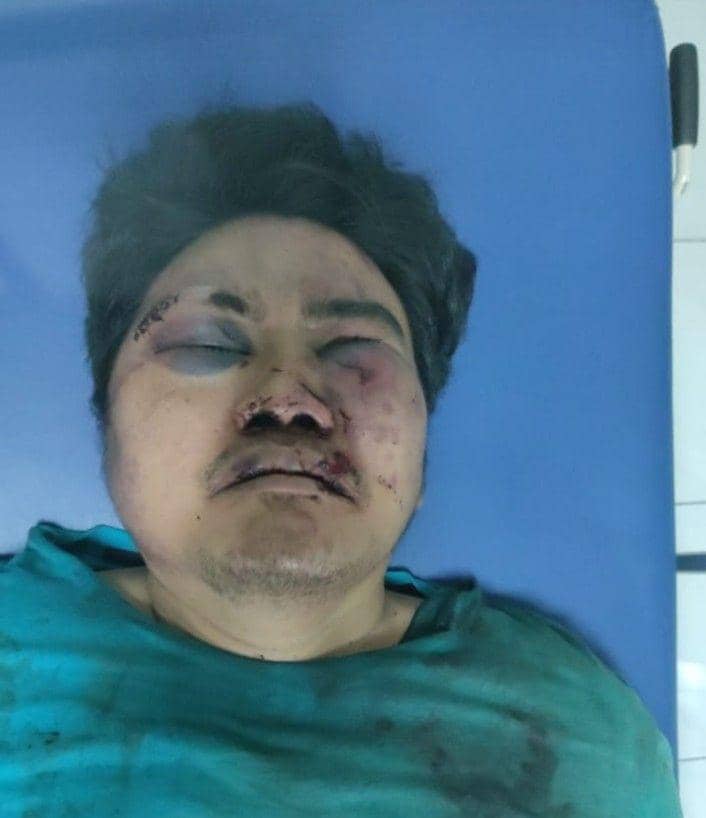 DM yang merupakan tersangka pengeroyokan TNI babak belur dikeroyok puluhan orang tak dikenal (dok.istimewa)