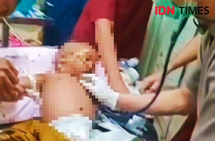 Polisi Periksa 8 Saksi Kasus Balita Diduga Disiksa Pengasuh di Bima