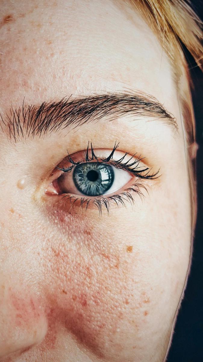 jenis kulit yang sangat kering (pexels.com/Almada Studio)
