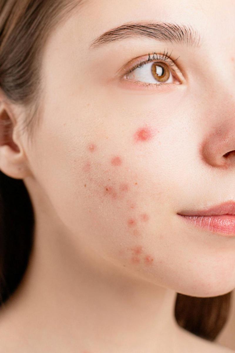 jenis kulit sensitif yang salah menggunakan produk skincare (pexels.com/Anna Nekrashevich)