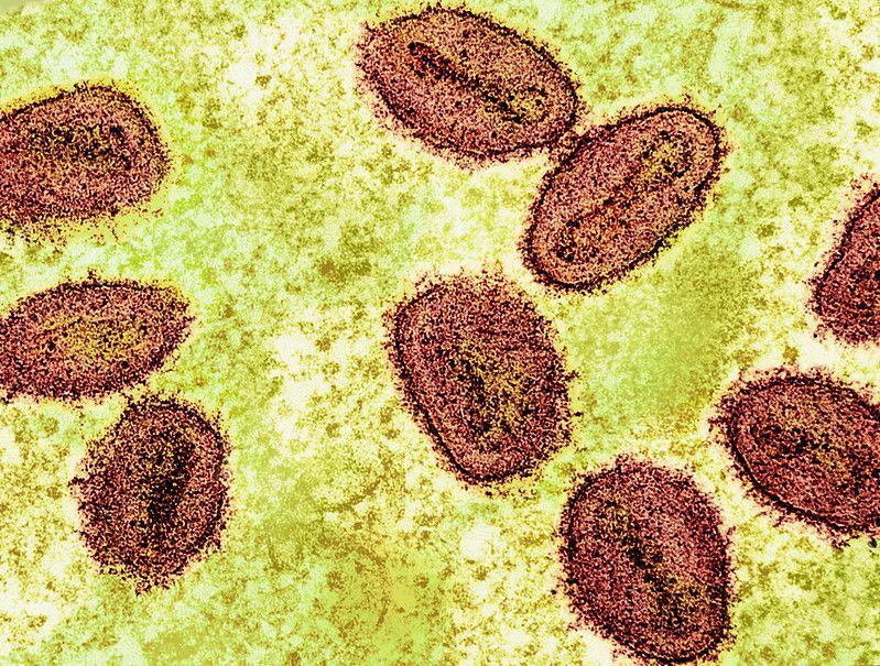 Apa Itu Mpox (Cacar Monyet)? Ini Gejala hingga Pengobatannya