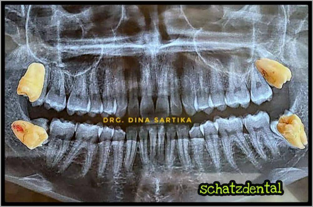 Klinik SCHATZ Dental Aesthetic Clinic (Instagram/schatzdental)