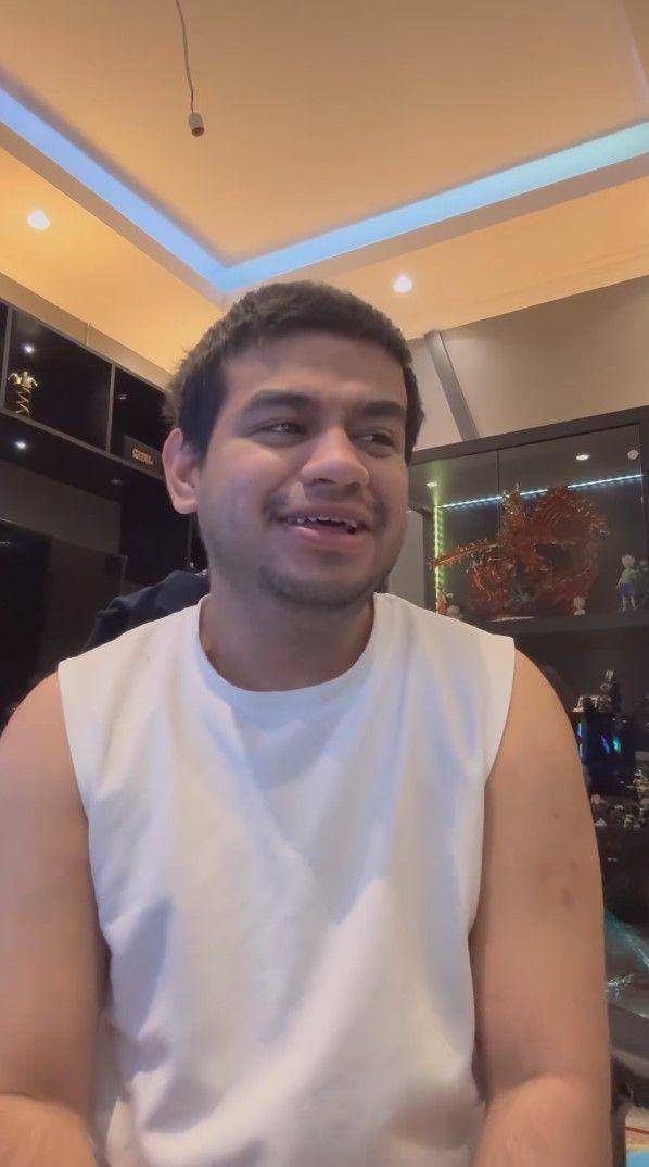 potret Fadil Jaidi tanam rambut (instagram.com/fadiljaidi)
