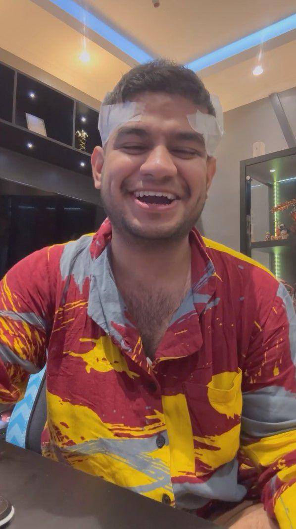 potret Fadil Jaidi tanam rambut (instagram.com/fadiljaidi)