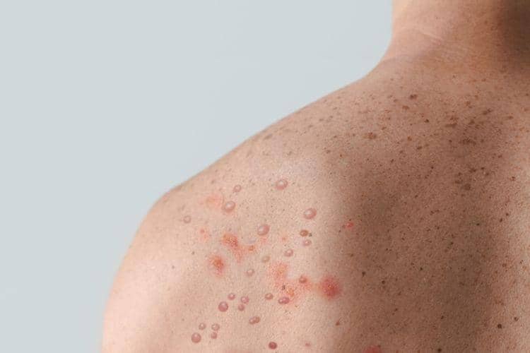 SHUTTERSTOCK/HALFPOINT