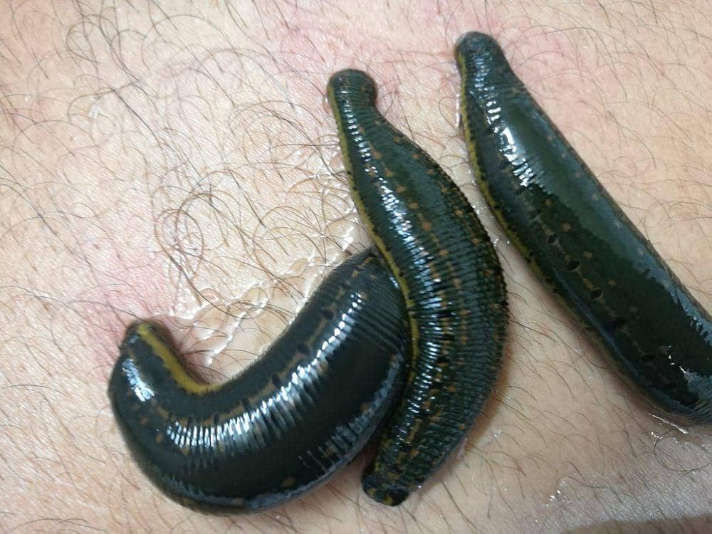 lintah hirudo medicinalis (commons.wikimedia.org/آرمین)