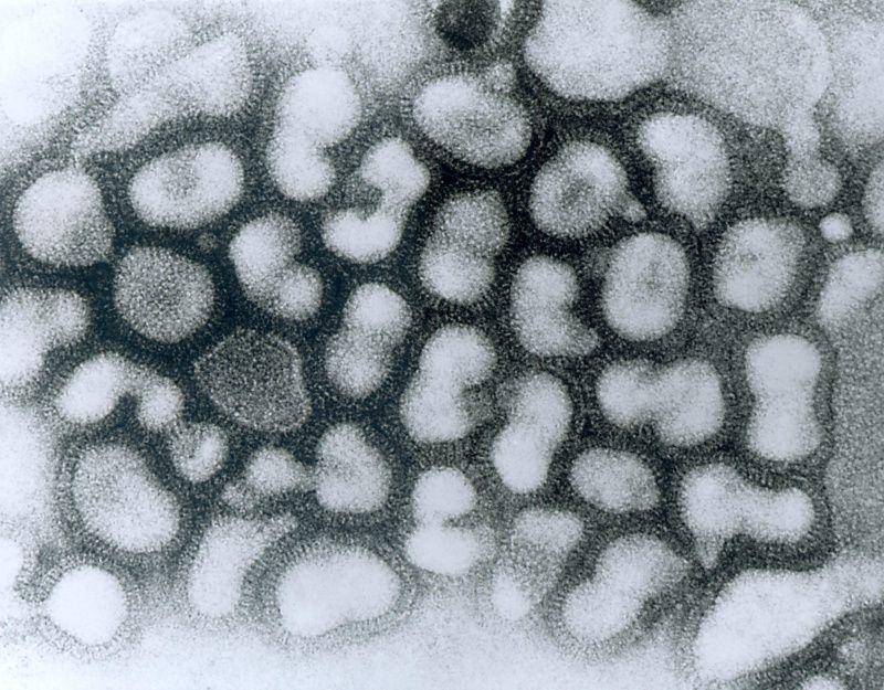 gambar virus influenza H5N1 di bawah mikroskop (commons.m.wikimedia.org/CDC/ Dr. Erskine Palmer)