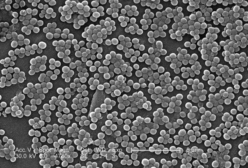 gambar bakteri MRSA di bawah mikroskop (commons.m.wikimedia.org/CDC/Janice Carr/Deepak Mandhalapu, M.H.S.)