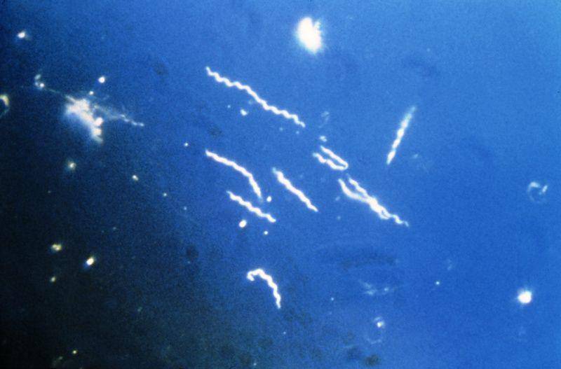 gambar bakteri borrelia burgdorferi (commons.m.wikimedia.org/CDC)