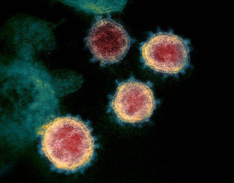 gambar virus SARS-CoV-2 (commons.m.wikimedia.org/NIAID-RML)