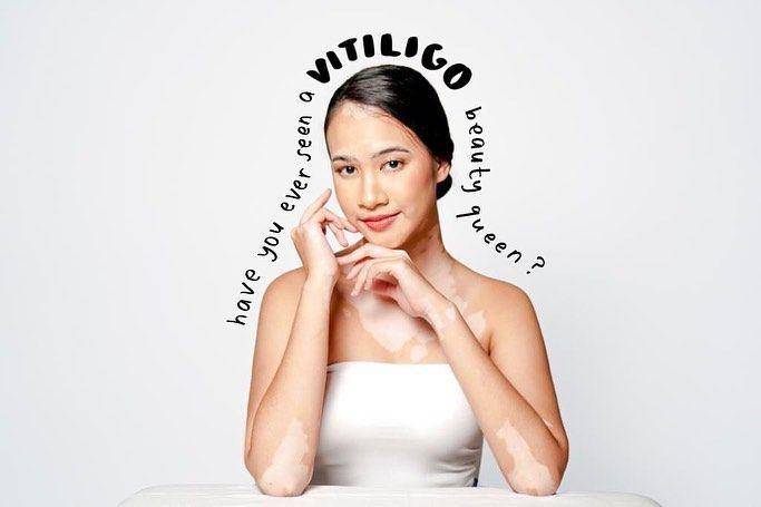 Salma Kyana, founder Mengenal Diri dan Puteri Indonesia DKI Jakarta Favorit 2023 (instagram.com/salmakyn)