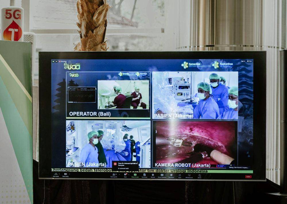 Kolaborasi Telkomsel dan Urological Association of Asia (UAA) menghadirkan Robotic Telesurgery pertama di Indonesia (dok. Telkomsel)