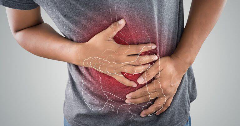 Ilustrasi penyakit Crohn (bgapc.com)