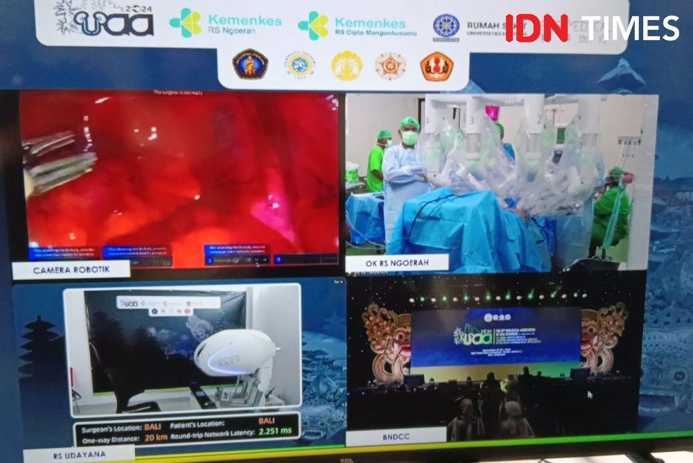 2 Rumah Sakit di Bali Kerja Sama Operasi Telerobotik Jarak 20 Km