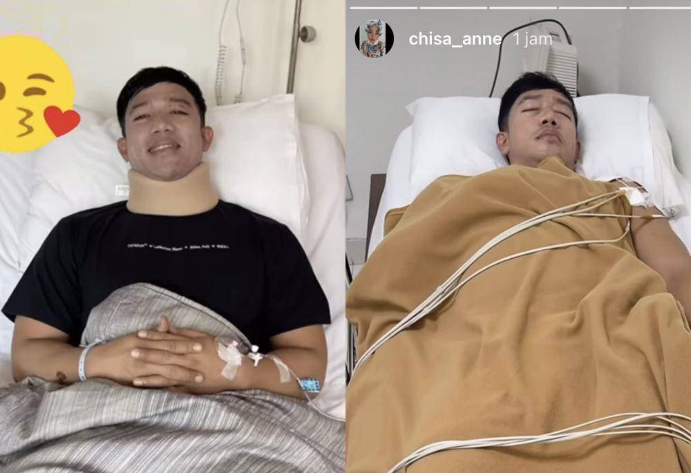 potret kondisi terkini Ruri Repvblik usai alami kecelakaan tunggal di Ciamis (Instagram.com/chisa_anne)