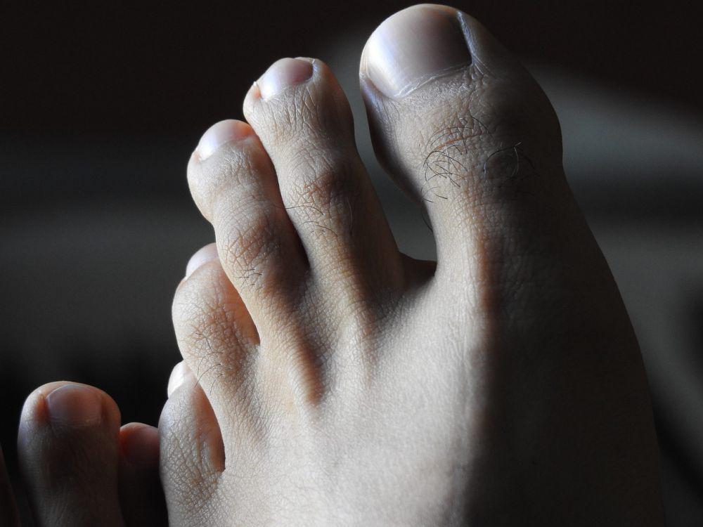 Ilustrasi jari kaki. (Pixabay.com/iGlobalWeb)