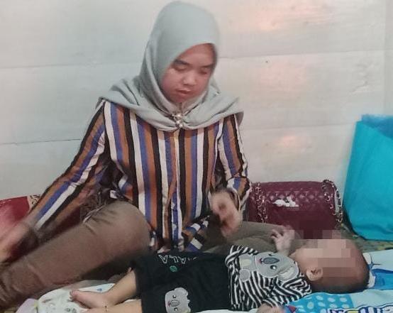 Derita Hipospadia, Bayi di Palembang Butuh Bantuan Pemerintah