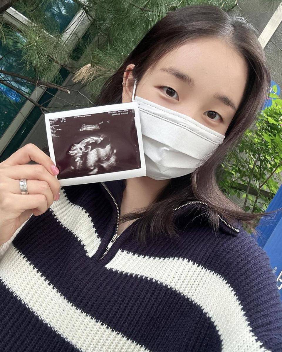 momen Baek A Yeon dari hamil hingga melahirkan anak pertama (instagram.com/ayeoniiiiii)