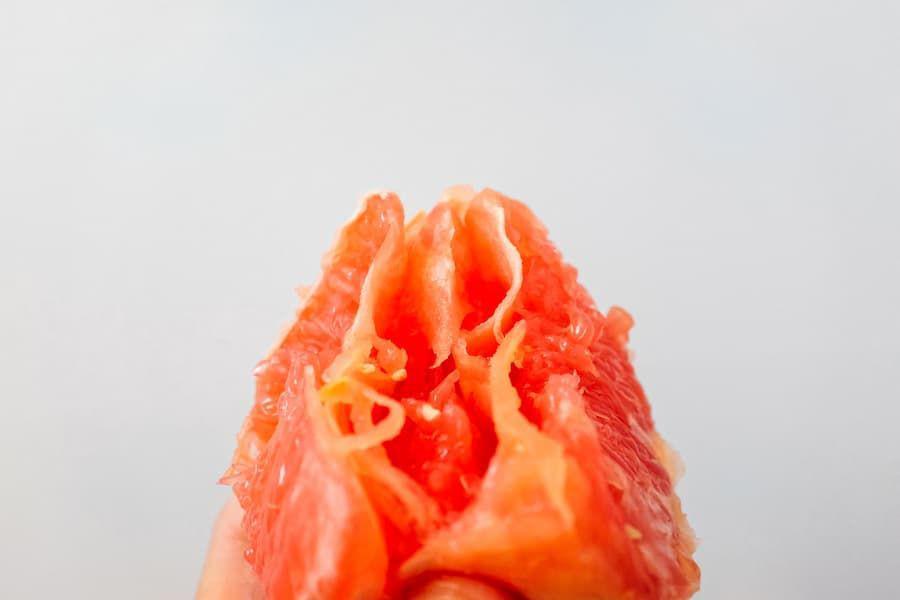 Bentuk Vagina Normal Seperti Apa? Begini Gambarannya