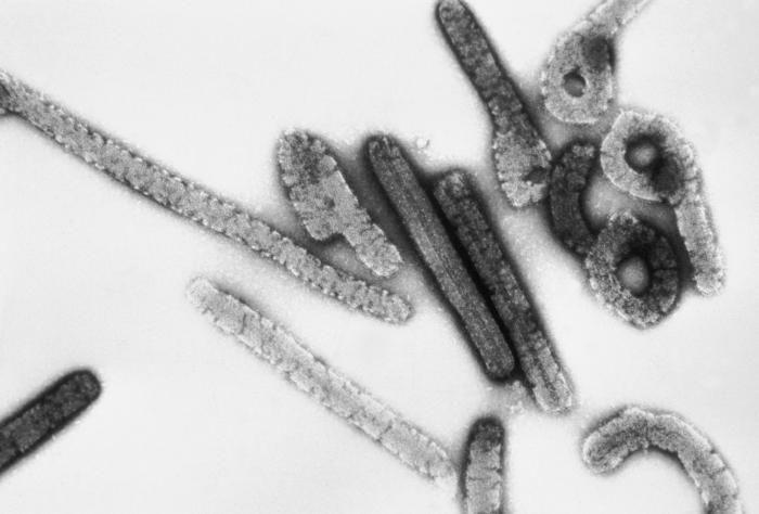 Gejala Virus Marburg, Tingkat Fatalitasnya hingga 80 Persen