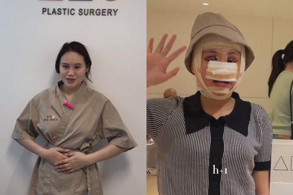 7 Potret Rani D'Academy Jalani Operasi Plastik di Korea