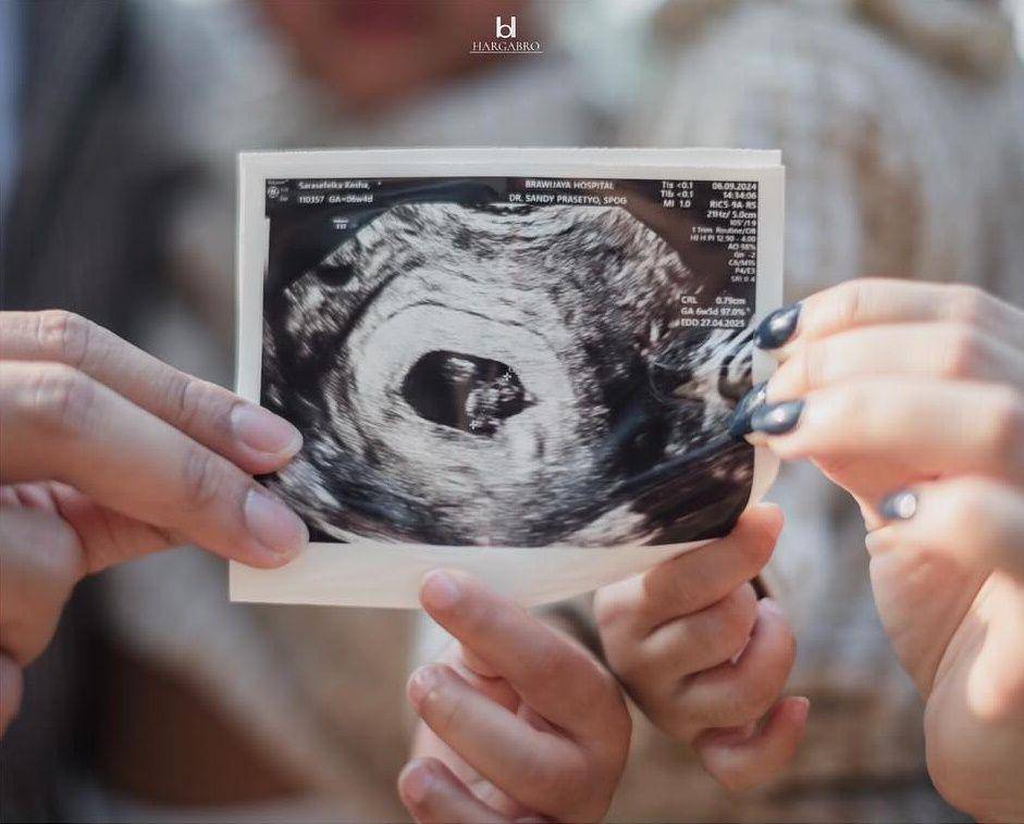potret Kesha Ratuliu umumkan kehamilan ketiga (instagram.com/hargabro)