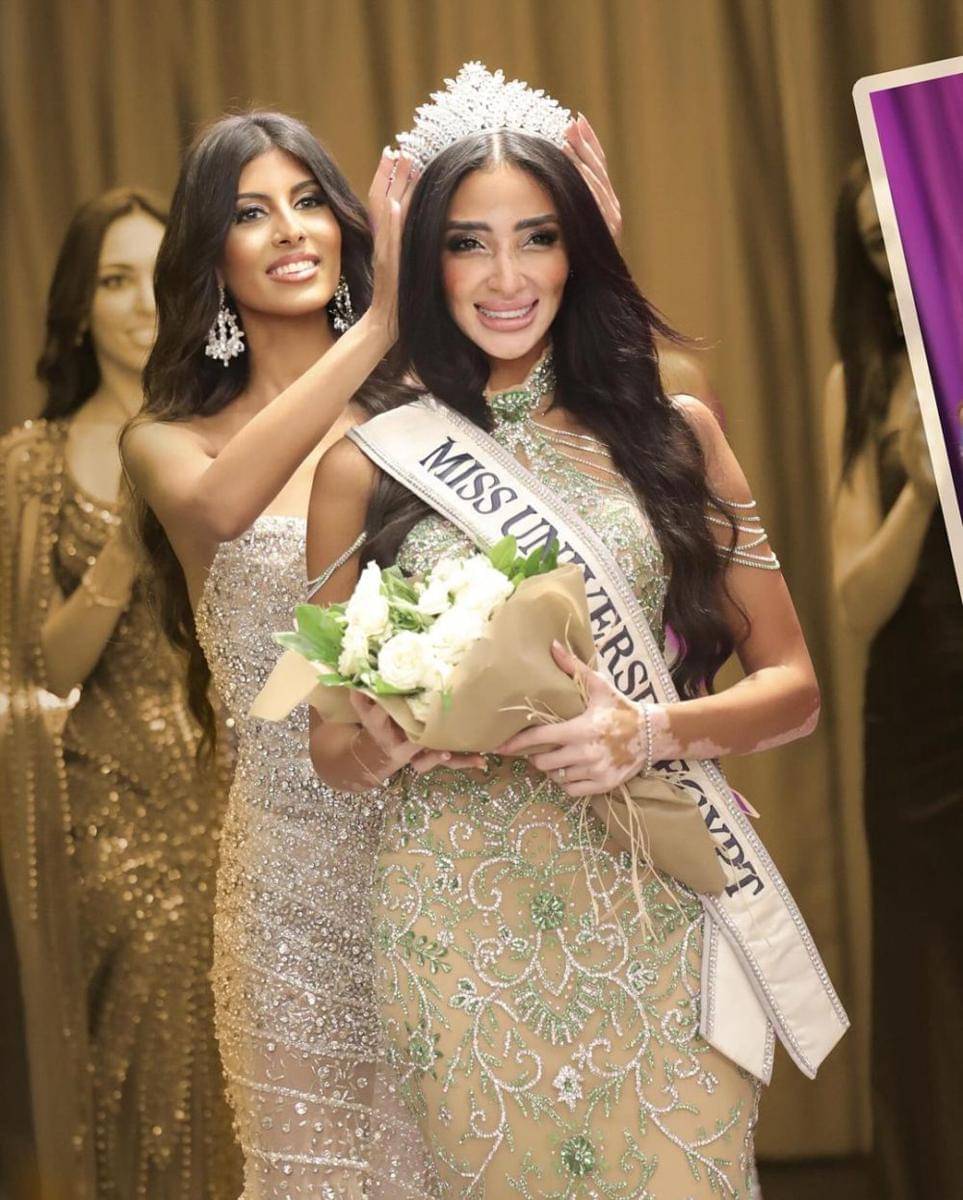 Potret Miss Universe Mesir 2024 Logina Salah (Instagram.com/missuniverse.egypt)