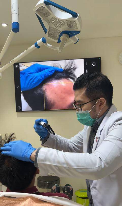 suami Tya Ariestya tanam rambut (Instagram.com/tya_ariestya)