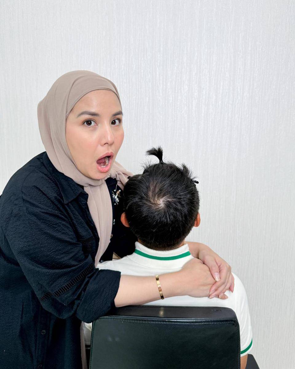 suami Tya Ariestya tanam rambut (Instagram.com/tya_ariestya)