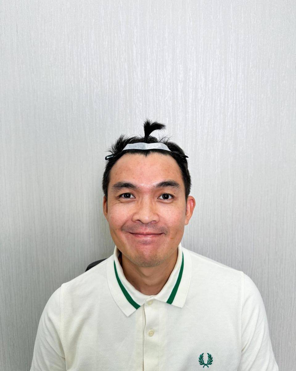suami Tya Ariestya tanam rambut (Instagram.com/tya_ariestya)