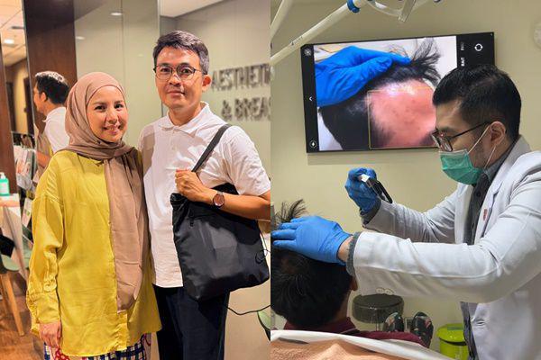 Alami Kebotakan, 7 Potret Suami Tya Ariestya Transplantasi Rambut