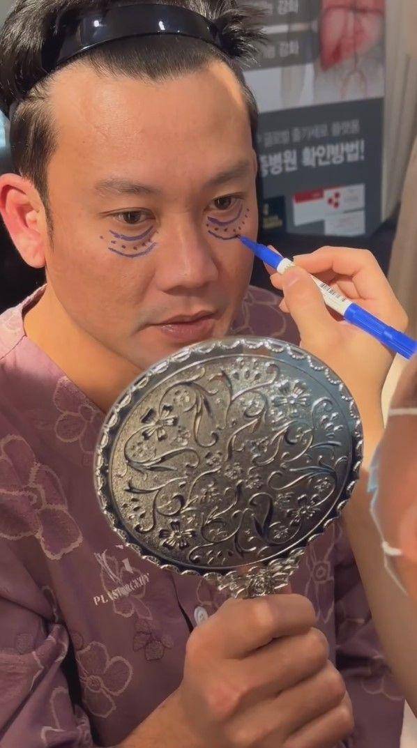 potret Denny Sumargo oplas di Korea (instagram.com/sumargodenny)