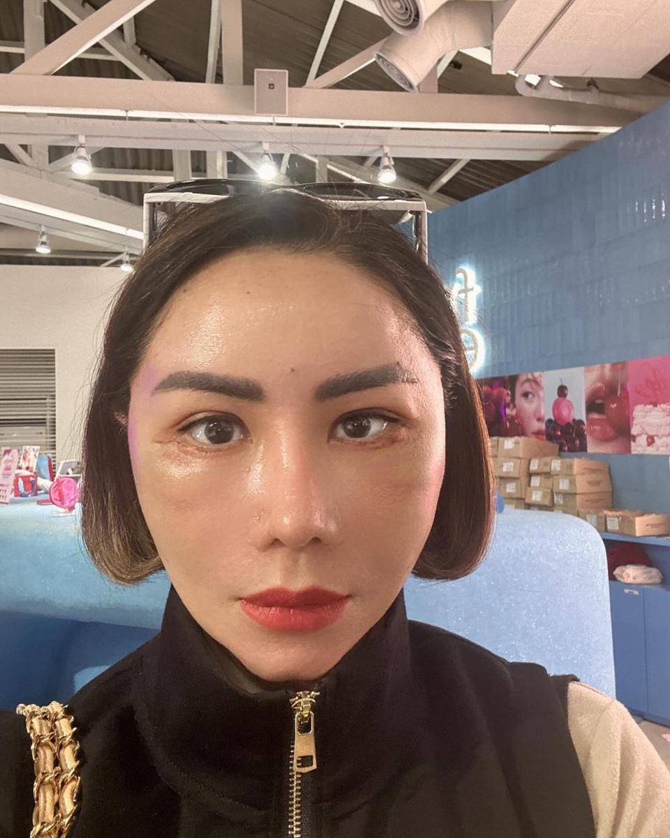 potret Femmy Permatasari operasi plastik di Korea (instagram.com/femmypermatasari)