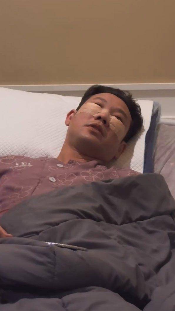 potret Denny Sumargo oplas di Korea (instagram.com/sumargodenny)