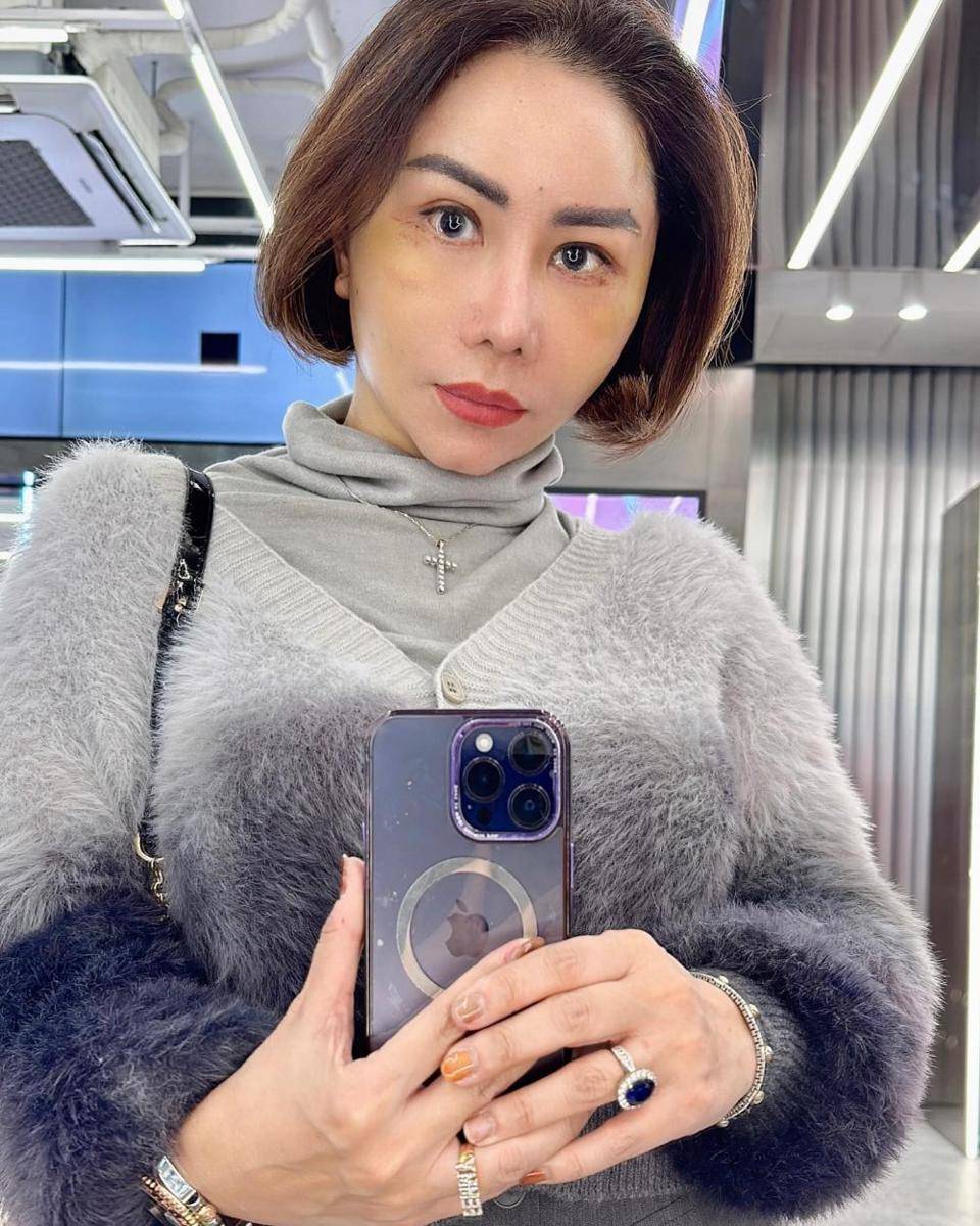 potret Femmy Permatasari operasi plastik di Korea (instagram.com/femmypermatasari)