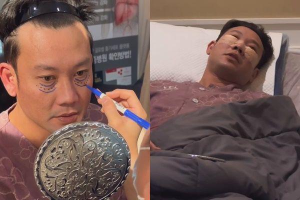 7 Potret Denny Sumargo Operasi Kantung Mata di Korea
