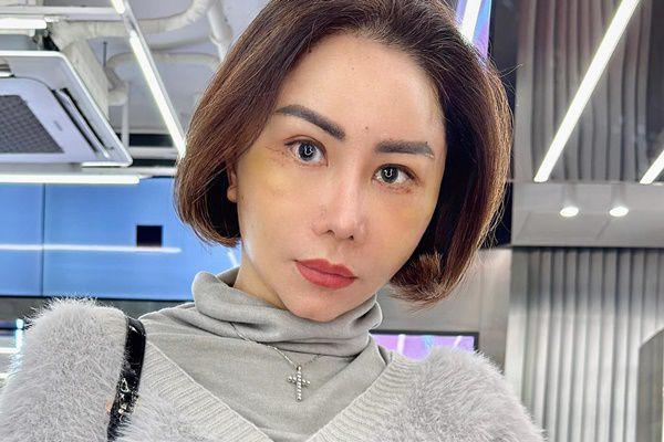 7 Potret Femmy Pertamasari Oplas Lagi di Korea