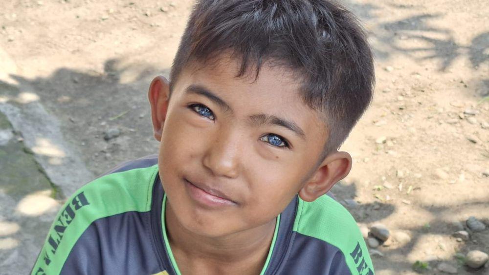 Nando Bocah Madiun Miliki Mata Biru, Berawal dari Lahir Prematur