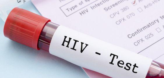 Belasan Warga Lotim Meninggal Dunia Akibat Terjangkit HIV/AIDS
