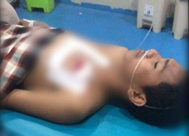 Randi (19) terluka di dada dan medapatkan perawatan di rumah sakit / Istimewa