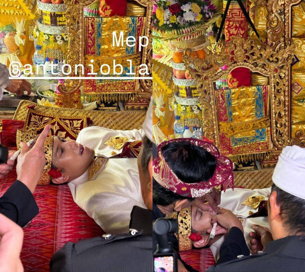 potret Antonio Blanco Jr jalani prosesi Potong Gigi (instagram.com/dimassinggih)