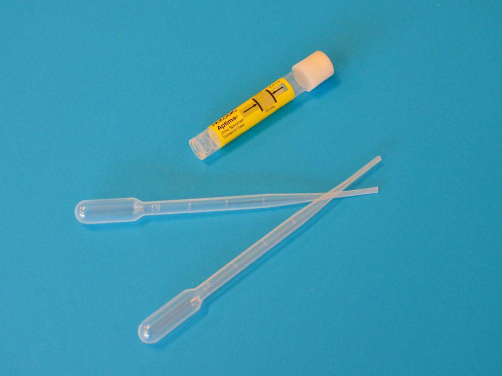 [QUIZ] Dari Karakteristik Urine Kamu, Ini Penyakit yang Harus Diwaspadai