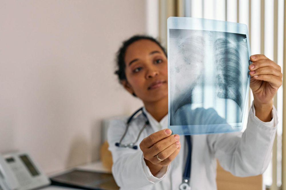Kenapa Pneumonia Bisa Sebabkan Kematian? Ini Penjelasan Dokter