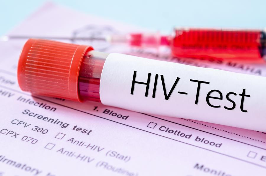 Kasus HIV di Cirebon Tinggi, 31 Persen Pengidap Belum Dapat Perawatan