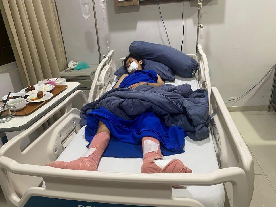 Korban Geng Motor di Depan UNM Luka Parah di Kaki, Gigi Patah