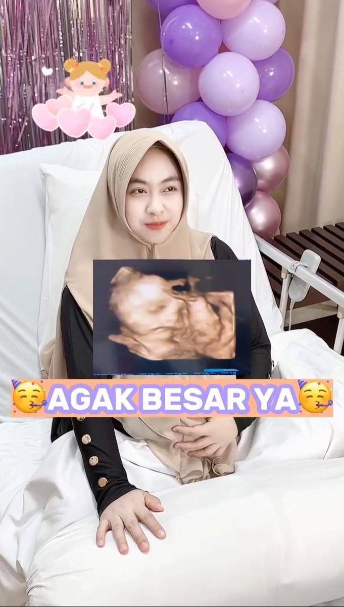 dr.Shindy melahirkan anak kedua ( Instagram.com/dr.shindyputri_)